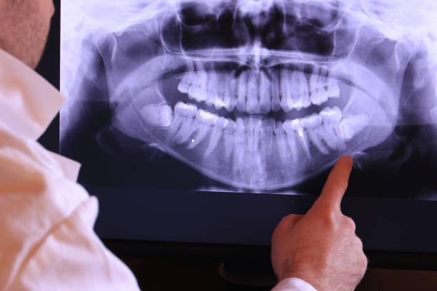 Best Mobile Emergency Dentist in Nice, CA