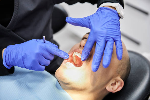 Best Emergency Dentist for Lost Fillings or Crowns in Nice, CA